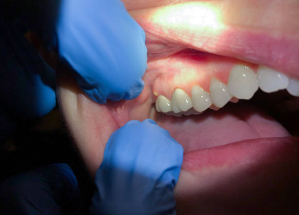 Best Cosmetic Emergency Dentistry in Bettendorf, IA